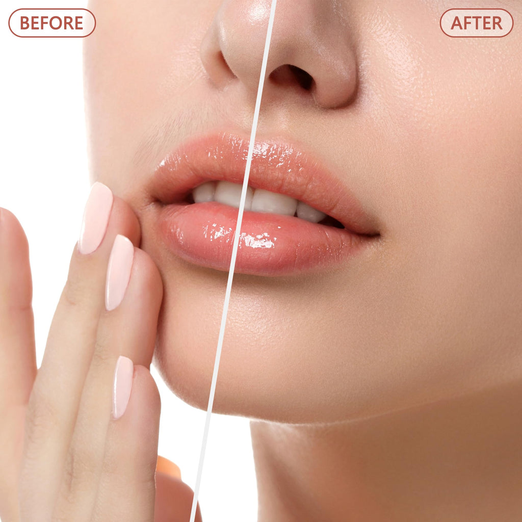 Facial Hair Remover N17443