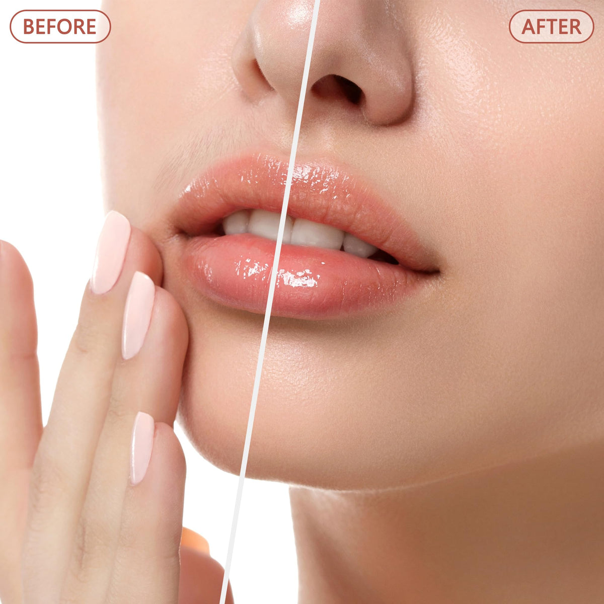 Facial Hair Remover N17443